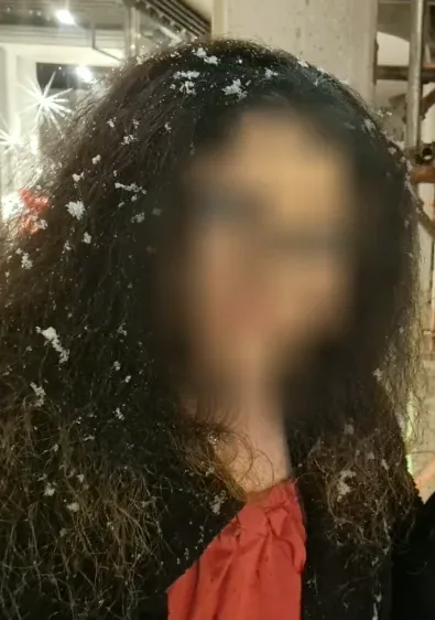 Netta, 24